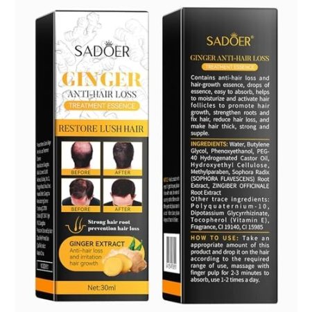 Sadoer Ginger Anti-Hair Loss Treatment Essence 30ml - Restores Hair, Promotes Growth