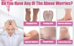 modulyss-moisturizing-silicone-gel-socks-for-women-and-men-gel-socks-for-dry-cracked-100-grm-1000×1000-1.webp
